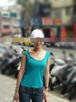 25岁女孩肺结核的康复病例